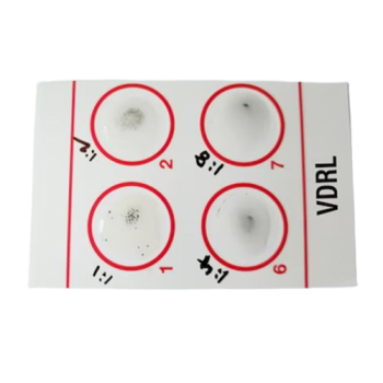 Prueba_Sifilis__RPR_-VDRL_-removebg-preview